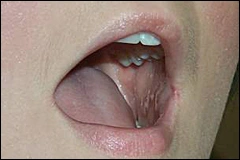 ce337 - Content - Lips - Figure 2