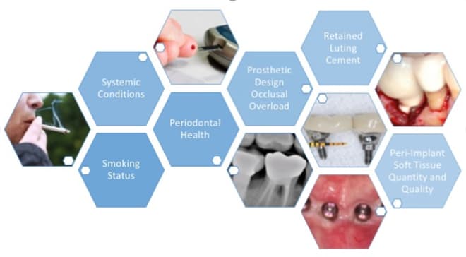 Risk Factors For Peri-implant Diseases - Laser Therapy For Adjunctive ...