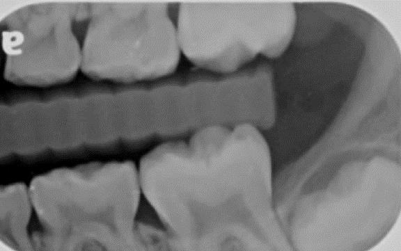 Management Techniques - Radiographic Techniques for the Pediatric ...