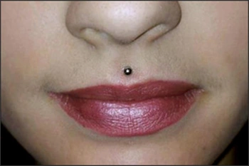 Image: Medusa piercing