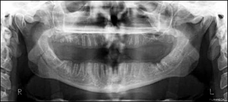 Features of an Ideal Panoramic Radiograph - Figure 1