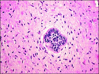  Case Challenge 44 - Content - Diagnostic Information - Figure 4