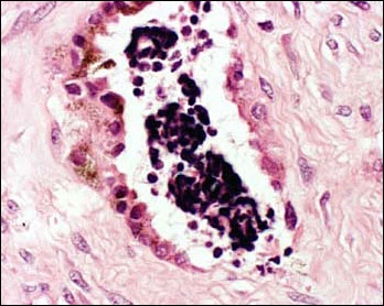 fig04-photomicrograph-high