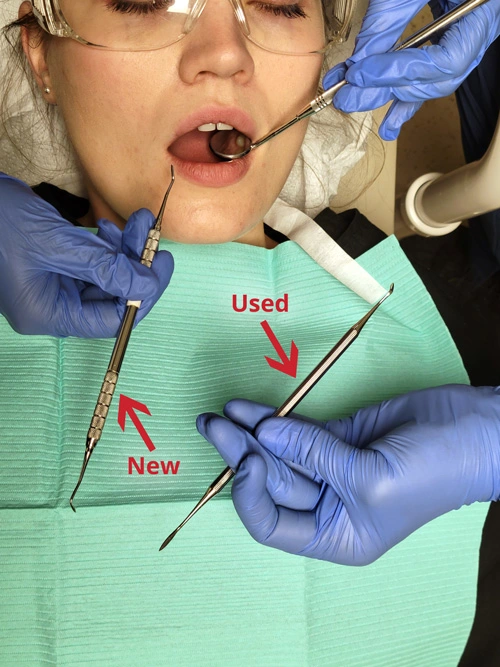 The Singlehanded Transfer The Concepts of Fourhanded Dentistry