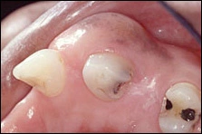 Case Challenge 10 - Content - Diagnostic Information - Figure 3