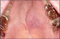 Case Challenge 15 - Content - Diagnostic Information - Figure 1