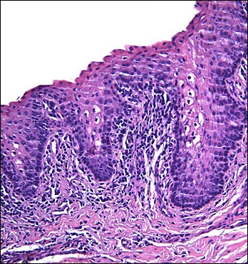 case challenge 46 - Content - Diagnostic Information - Figure 4