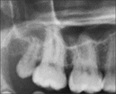 Alterations in the Size of Teeth - Figure 2