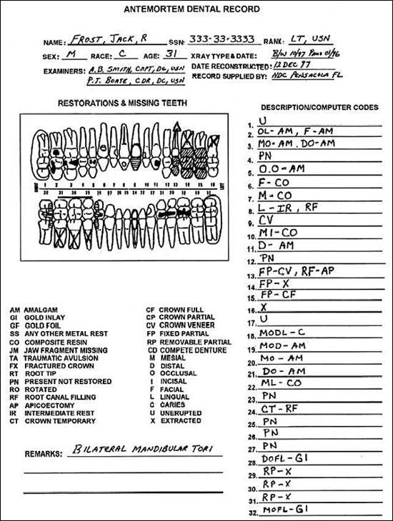 Ante-mortem Dental Record Documentation (CAPMI System).