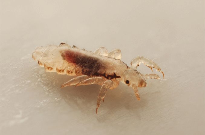 zoomed in image of eyelash lice