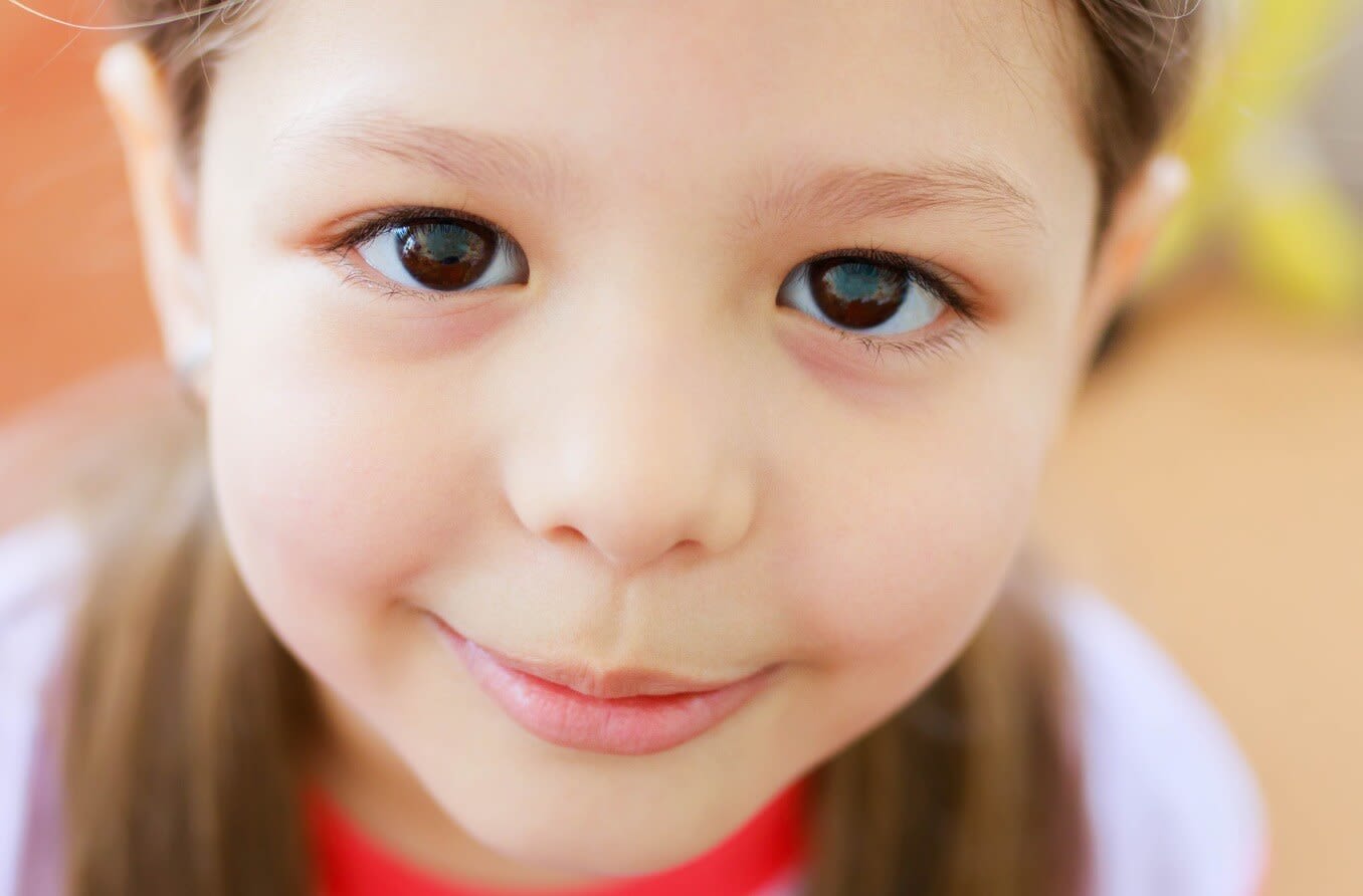 Child with large brown eyes.