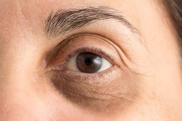 El porqué de los ojos rojos e irritados y cómo ponerle remedio