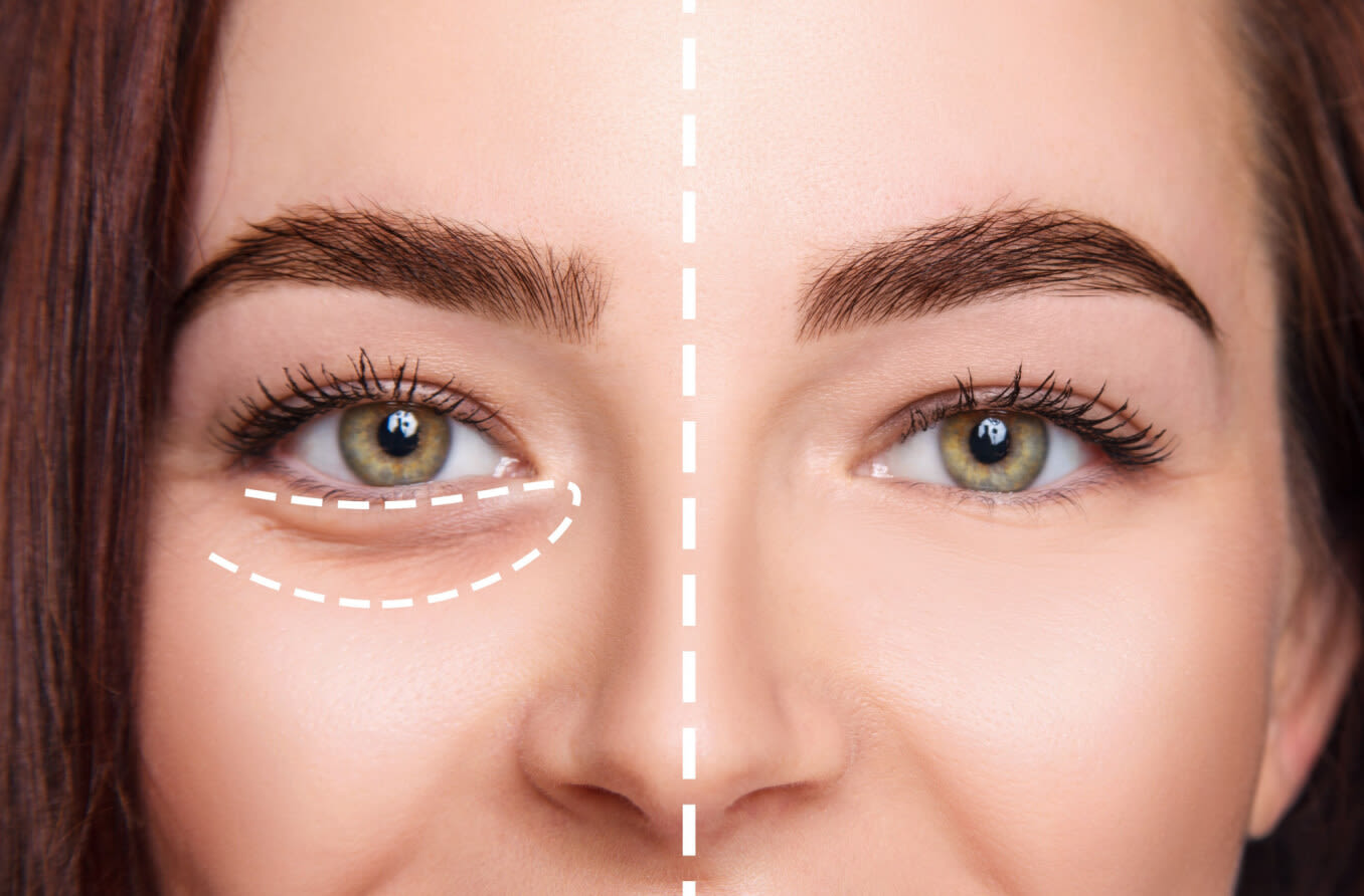 How to Conceal Under-Eye Bags in 5 Easy Steps