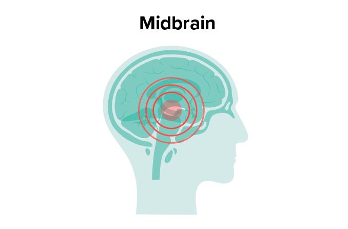 illustration of the midbrain - where Parinaud syndrome occurs