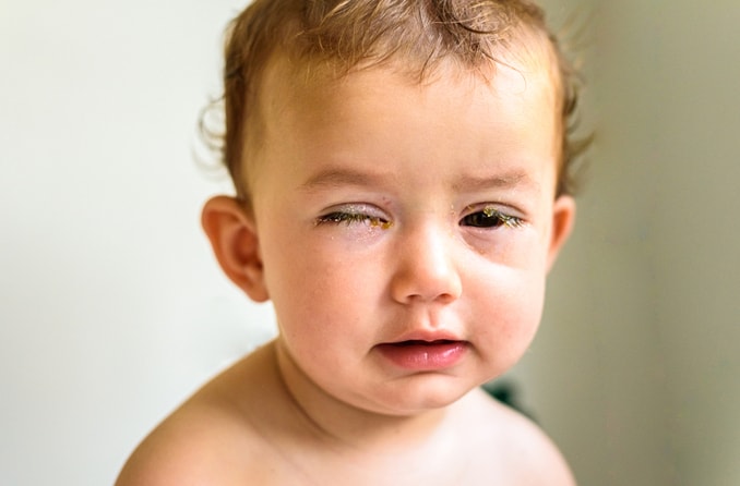 Under-Eye Swelling: Causes, Symptoms And Treatments – Forbes Health