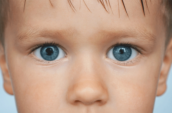 unequal pupil size infants