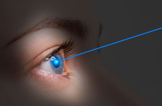 Persona che riceve la correzione Lasik per la miopia