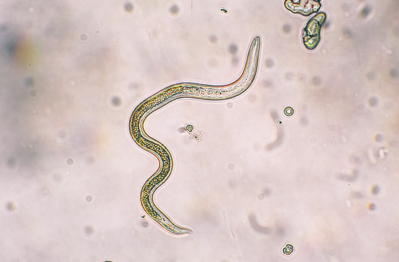 Toxocariasis parasite