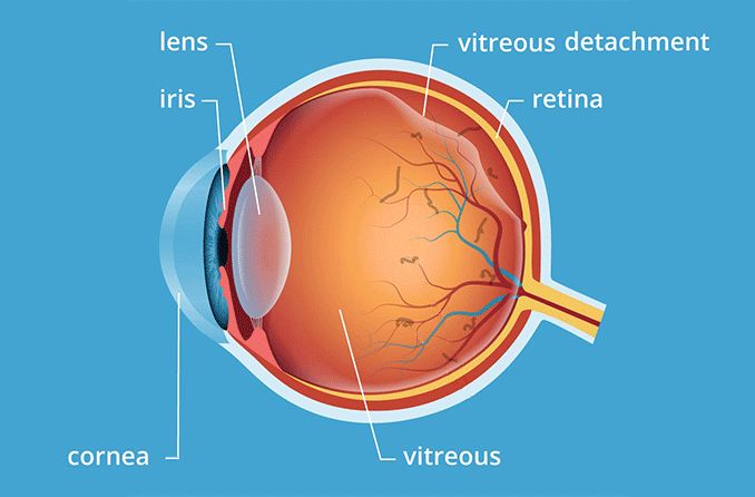eyeball illustration of vitreous humor
