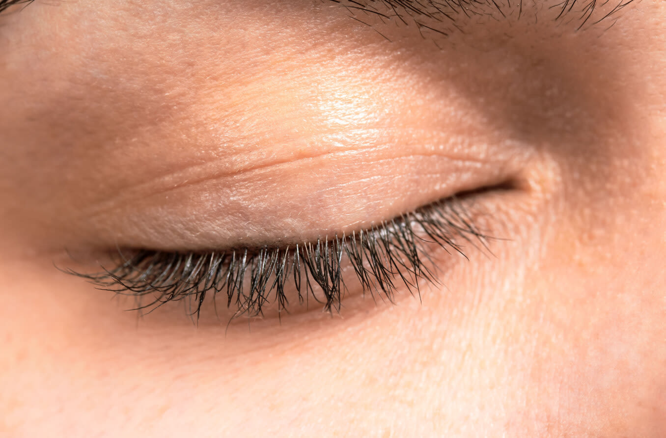 Depiction of an eyelid closed tight