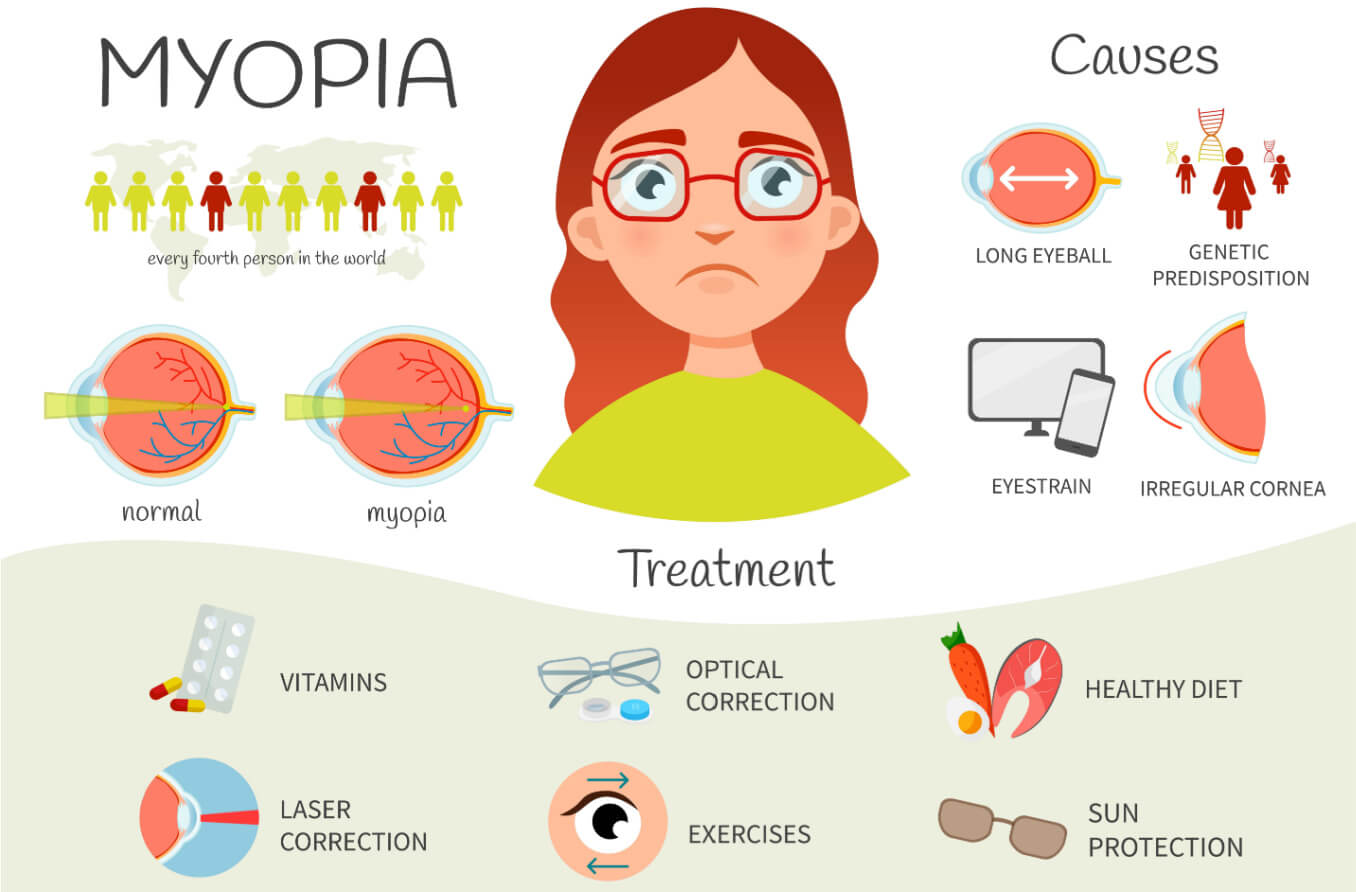 Chart describing myopia information