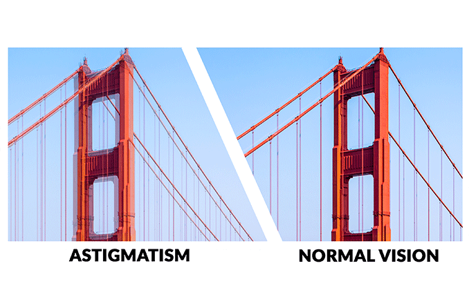 astigmatism od meaning