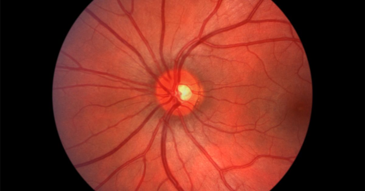 Imagen de la parte posterior de un ojo sano