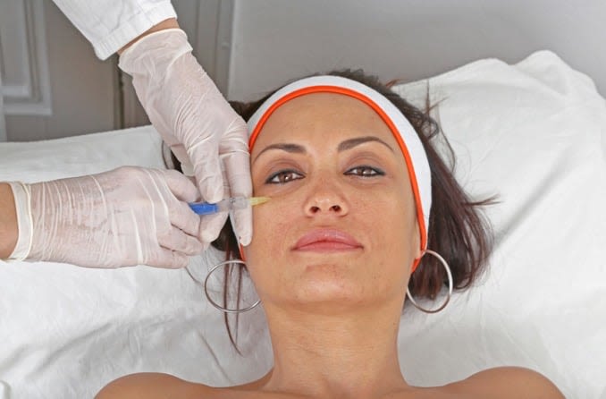 Woman with dark hair and brown eyes is lying back to receive under-eye filler injections.