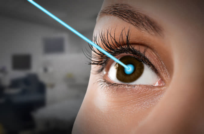 Montagem de um olho recebendo laser na cirurgia Lasik

