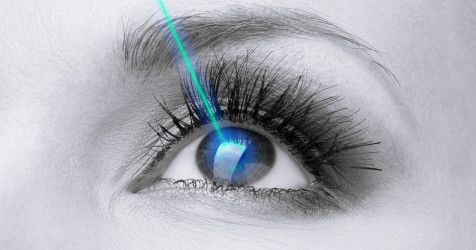 激光眼科手术的描述