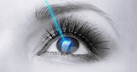 Lasik Procedure A Guide For What To Expect All About Vision