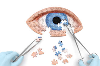 eye surgeon assembling puzzle pieces with medical tools
