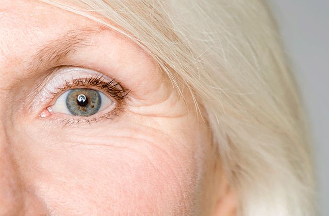 older woman with crow's feet around her eye