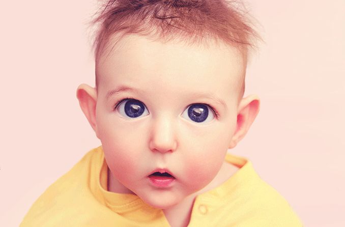 baby with megalocornea eyes