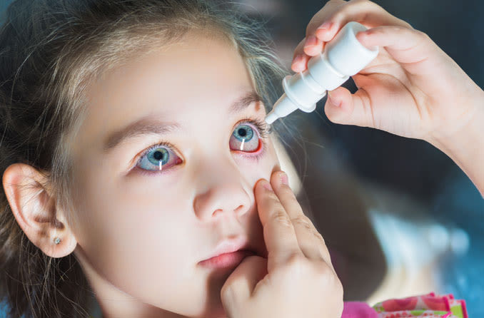 A girl uses eye drops for allergy relief