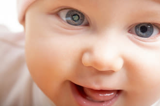 bébé avec cataracte congénitale