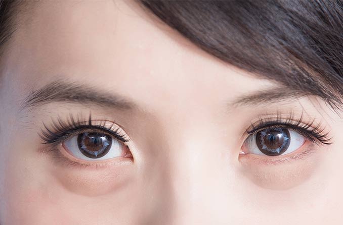 Bọng mắt: Cách loại bỏ bọng mắt