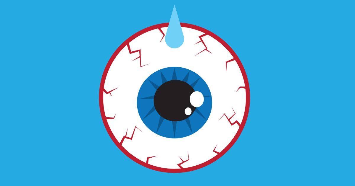 cartoon of dry eye