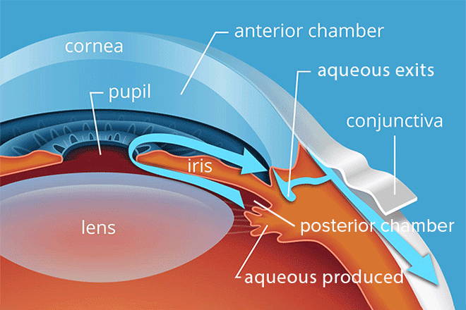 Flow chart of the current study. IOP, intraocular pressure