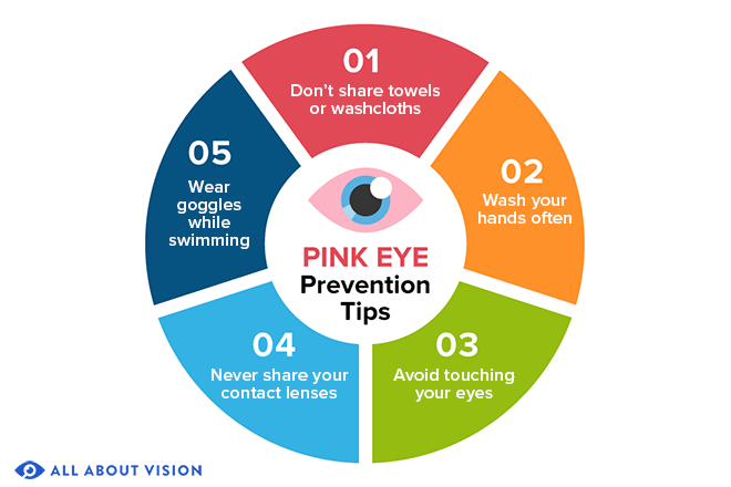 Pink Eye (Conjunctivitis) - All About Vision