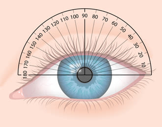 Suburbio el propósito rima Tipos de astigmatismo y tratamientos | All About Vision