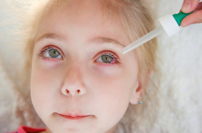 Little girl with pink eye receiving eye drops