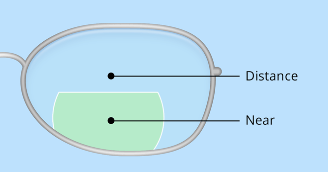 「bifocal lens」的圖片搜尋結果