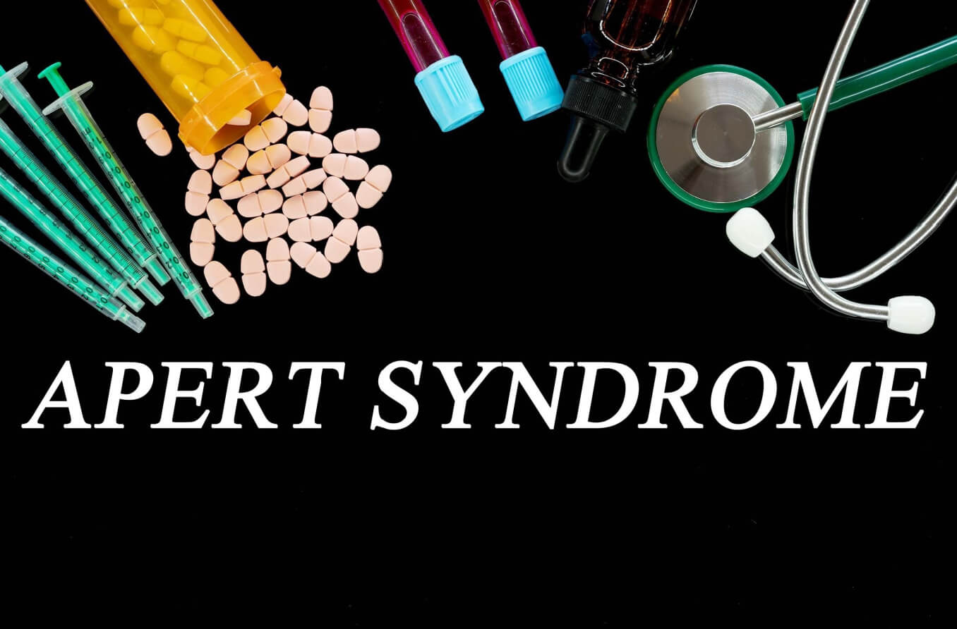 Apert syndrome text