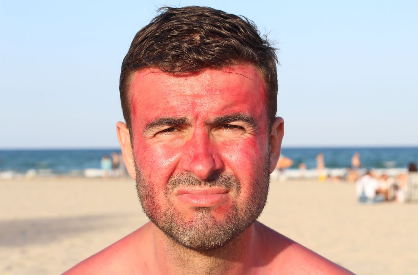 Person on the beach squinting from sun glare.