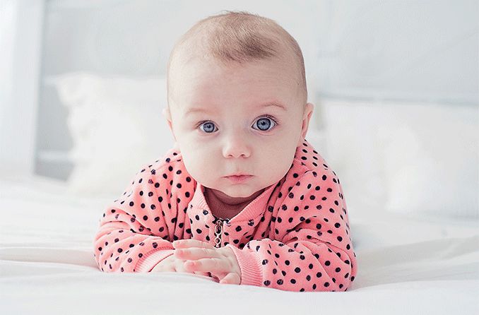 baby with small eye syndrome (microphthalmia)