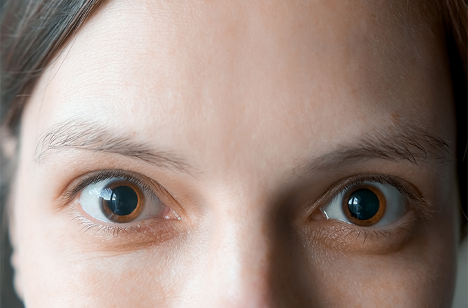 Eye Dilation FAQs What To Know About The Eye Dilation Exam   Eye Dilation 678x446 