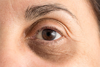 Hemorrhoid cream has weird benefits for undereye area