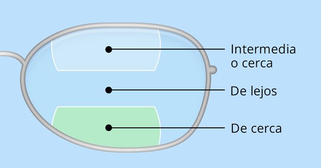 Óptica explica lentes bifocales simples y progresivas generativas ia