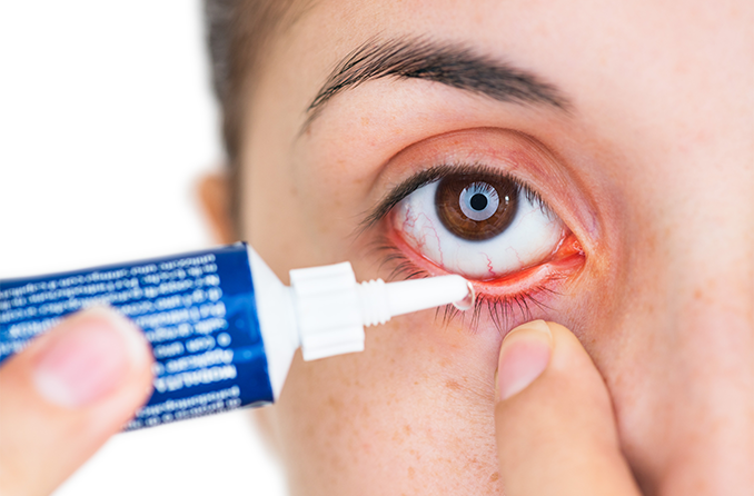 Antibiotic Eye Ointments: Uses, Side Effects, Dosages